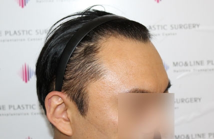 치료후기 이미지
