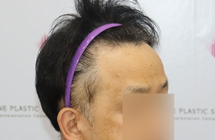 치료후기 이미지