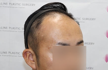 치료후기 이미지