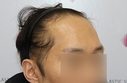 치료후기 이미지