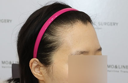치료후기 이미지