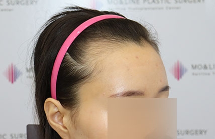 치료후기 이미지