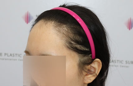 치료후기 이미지