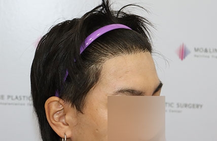 치료후기 이미지