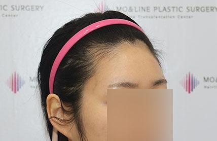 치료후기 이미지