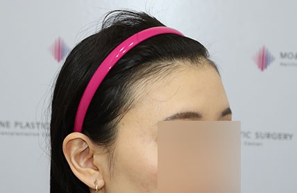 치료후기 이미지