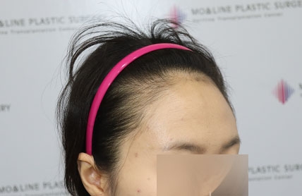 치료후기 이미지