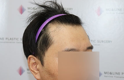 치료후기 이미지