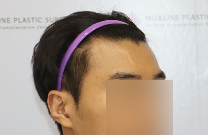 치료후기 이미지