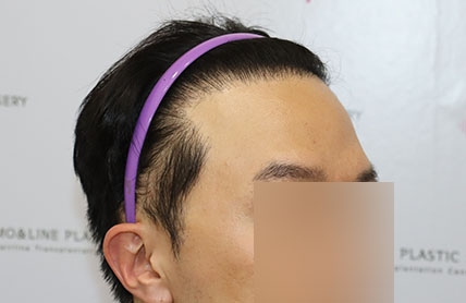 치료후기 이미지
