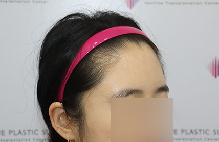치료후기 이미지