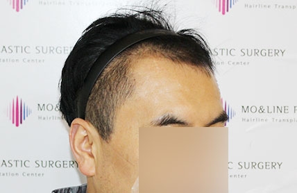 치료후기 이미지