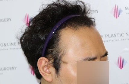 치료후기 이미지
