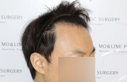 치료후기 이미지