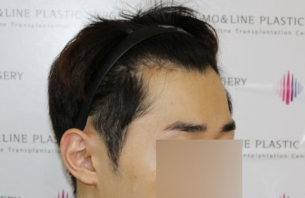 치료후기 이미지