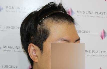 치료후기 이미지