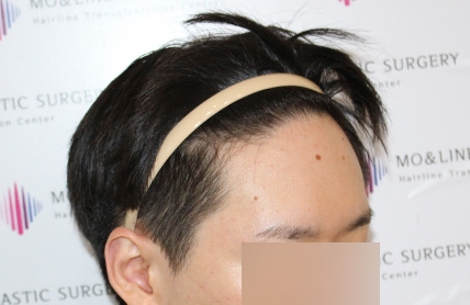 치료후기 이미지