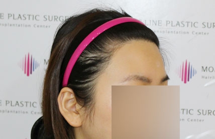 치료후기 이미지