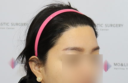 치료후기 이미지