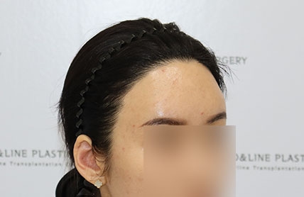 치료후기 이미지