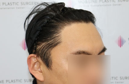 치료후기 이미지
