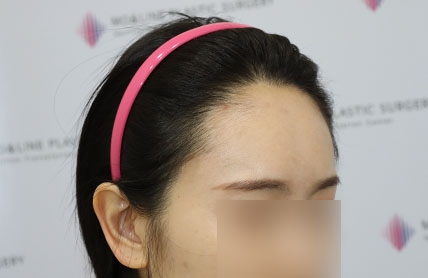 치료후기 이미지