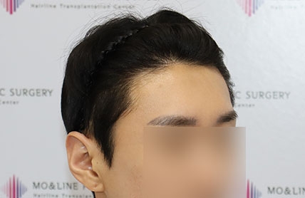 치료후기 이미지