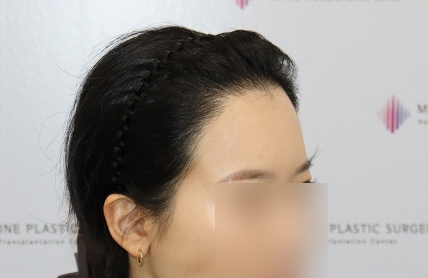 치료후기 이미지