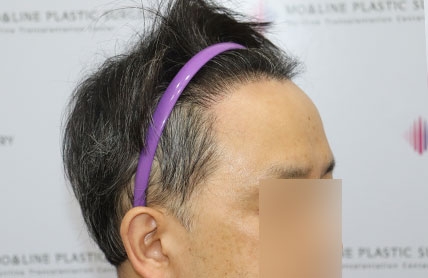 치료후기 이미지