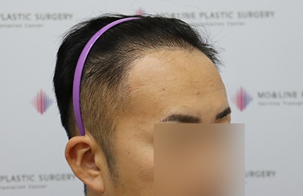 치료후기 이미지
