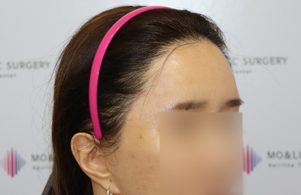 치료후기 이미지