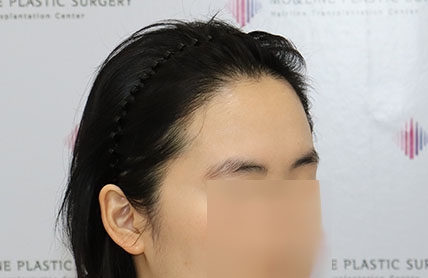 치료후기 이미지