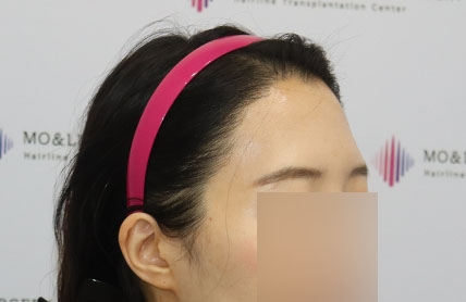 치료후기 이미지