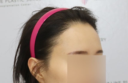치료후기 이미지