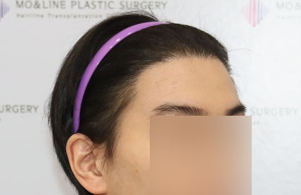 치료후기 이미지