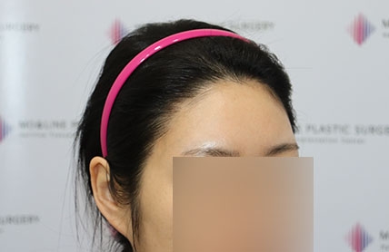 치료후기 이미지