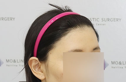 치료후기 이미지