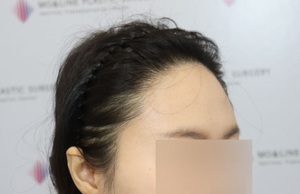 치료후기 이미지