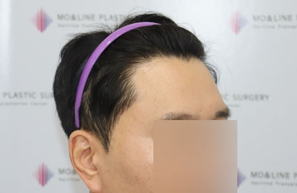 치료후기 이미지