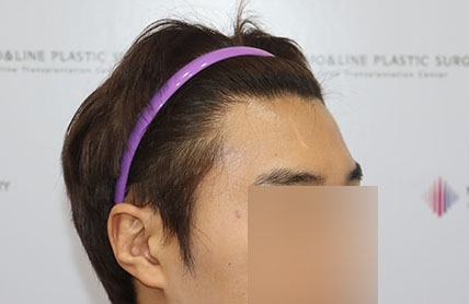 치료후기 이미지