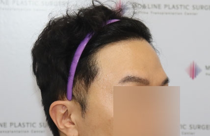 치료후기 이미지