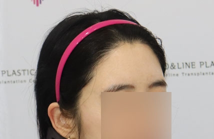 치료후기 이미지