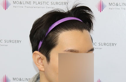 치료후기 이미지