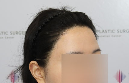 치료후기 이미지
