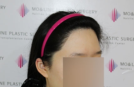 치료후기 이미지