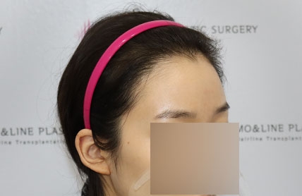 치료후기 이미지