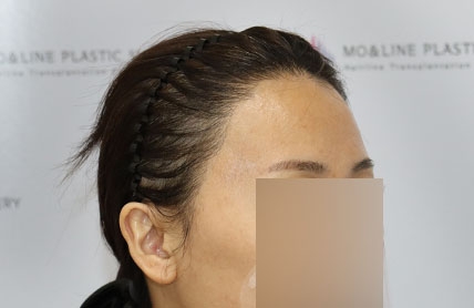 치료후기 이미지