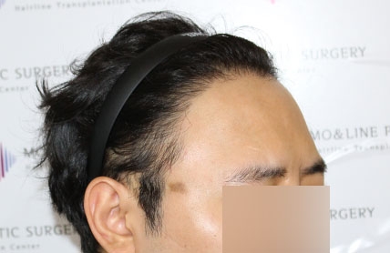 치료후기 이미지
