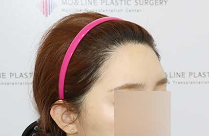 치료후기 이미지