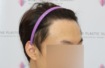 치료후기 이미지